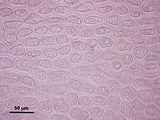 6 - Visione superficiale delle cellule corticali nella porzione apicale del tallo